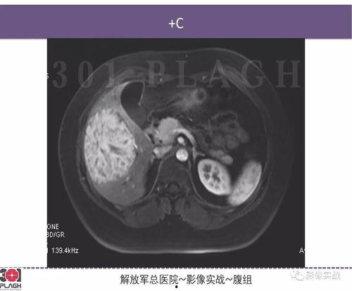 301病理在线视频,深入解析病理诊断的奥秘  第2张