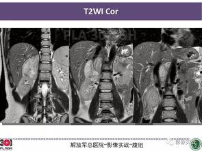 301病理在线视频,深入解析病理诊断的奥秘  第3张